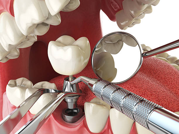 Best Emergency Denture Repair in Brownville, NJ